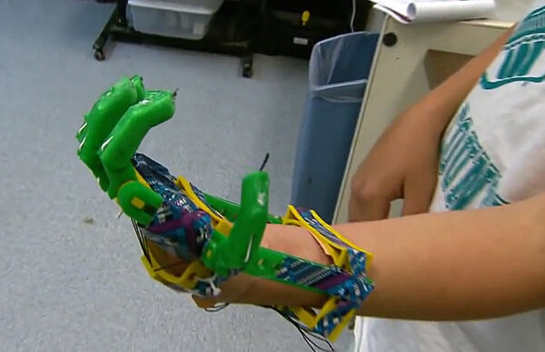 Boy Gets 3D Printed Prosthetic Hand